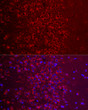 Immunofluorescence analysis of paraffin-embedded rat brain using G Secondary antibody: Cy3-conjugated Goat anti-Rabbit IgG (H+L) (STJS001166) at 1:500 dilution. Blue: DAPI for nuclear staining.