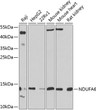 Western blot analysis of various lysates using NDUFA6 Rabbit pAb (STJ111873) at 1:1000 dilution. <br/>Secondary antibody: HRP-conjugated Goat anti-Rabbit IgG (H+L) (STJS000856) at 1:10000 dilution. <br/>Lysates/proteins: 25 Mu g per lane. <br/>Blocking buffer: 3% nonfat dry milk in TBST. <br/>Detection: ECL Basic Kit <br/>Exposure time: 90s.