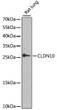 Western blot analysis of lysates from rat lung, using CLDN10 Rabbit pAb (STJ111895) at 1:1000 dilution. <br/>Secondary antibody: HRP-conjugated Goat anti-Rabbit IgG (H+L) (STJS000856) at 1:10000 dilution. <br/>Lysates/proteins: 25 Mu g per lane. <br/>Blocking buffer: 3% nonfat dry milk in TBST. <br/>Detection: ECL Enhanced Kit <br/>Exposure time: 60s.