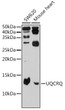 Western blot analysis of various lysates using UQCRQ Rabbit pAb (STJ111914) at 1:500 dilution. <br/>Secondary antibody: HRP-conjugated Goat anti-Rabbit IgG (H+L) (STJS000856) at 1:10000 dilution. <br/>Lysates/proteins: 25 Mu g per lane. <br/>Blocking buffer: 3% nonfat dry milk in TBST. <br/>Detection: ECL Basic Kit <br/>Exposure time: 180s.