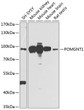 Western blot analysis of various lysates using POMGNT1 Rabbit pAb (STJ111921) at 1:1000 dilution. <br/>Secondary antibody: HRP-conjugated Goat anti-Rabbit IgG (H+L) (STJS000856) at 1:10000 dilution. <br/>Lysates/proteins: 25 Mu g per lane. <br/>Blocking buffer: 3% nonfat dry milk in TBST. <br/>Detection: ECL Basic Kit <br/>Exposure time: 60s.
