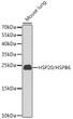 Western blot analysis of lysates from mouse lung, using HSP20/HSPB6 Rabbit pAb (STJ111929) at 1:1000 dilution. <br/>Secondary antibody: HRP-conjugated Goat anti-Rabbit IgG (H+L) (STJS000856) at 1:10000 dilution. <br/>Lysates/proteins: 25 Mu g per lane. <br/>Blocking buffer: 3% nonfat dry milk in TBST. <br/>Detection: ECL Basic Kit <br/>Exposure time: 90s.