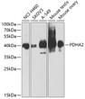 Western blot analysis of various lysates using PDHA2 Rabbit pAb (STJ111984) at 1:1000 dilution. <br/>Secondary antibody: HRP-conjugated Goat anti-Rabbit IgG (H+L) (STJS000856) at 1:10000 dilution. <br/>Lysates/proteins: 25 Mu g per lane. <br/>Blocking buffer: 3% nonfat dry milk in TBST. <br/>Detection: ECL Enhanced Kit <br/>Exposure time: 60s. Western blot analysis of various lysates using PDHA2 Rabbit pAb (STJ111984) at 1:1000 dilution. <br/>Secondary antibody: HRP-conjugated Goat anti-Rabbit IgG (H+L) (STJS000856) at 1:10000 dilution. <br/>Lysates/proteins: 25 Mu g per lane. <br/>Blocking buffer: 3% nonfat dry milk in TBST. <br/>Detection: ECL Enhanced Kit <br/>Exposure time: 60s.