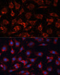 Immunofluorescence analysis of C6 cells using PDHA2 Rabbit pAb (STJ111984) at dilution of 1:100 (40x lens). Secondary antibody: Cy3-conjugated Goat anti-Rabbit IgG (H+L) (STJS001166) at 1:500 dilution. Blue: DAPI for nuclear staining. Immunofluorescence analysis of C6 cells using PDHA2 Rabbit pAb (STJ111984) at dilution of 1:100 (40x lens). Secondary antibody: Cy3-conjugated Goat anti-Rabbit IgG (H+L) (STJS001166) at 1:500 dilution. Blue: DAPI for nuclear staining.