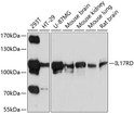 Western blot analysis of extracts of various cell lines, using IL17RD antibody (STJ112071) at 1:1000 dilution. Secondary antibody: HRP Goat Anti-Rabbit IgG (H+L) (STJS000856) at 1:10000 dilution. Lysates/proteins: 25 Mu g per lane. Blocking buffer: 3% nonfat dry milk in TBST. Detection: ECL Basic Kit. Exposure time: 30s.