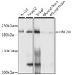 Western blot analysis of various lysates using [KO Validated] UBE2O Rabbit polyclonal antibody (STJ112076) at 1:1000 dilution. Secondary antibody: HRP Goat Anti-Rabbit IgG (H+L) (STJS000856) at 1:10000 dilution. Lysates/proteins: 25 Mu g per lane. Blocking buffer: 3% nonfat dry milk in TBST. Detection: ECL Basic Kit. Exposure time: 1s.