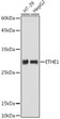 Western blot analysis of extracts of various cell lines, using ETHE1 antibody (STJ112181) at 1:1000 dilution. Secondary antibody: HRP Goat Anti-Rabbit IgG (H+L) (STJS000856) at 1:10000 dilution. Lysates/proteins: 25 Mu g per lane. Blocking buffer: 3% nonfat dry milk in TBST. Detection: ECL Basic Kit. Exposure time: 180s.