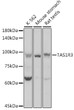 Western blot analysis of extracts of various cell lines, using TAS1R3 antibody (STJ112196) at 1:1000 dilution. Secondary antibody: HRP Goat Anti-Rabbit IgG (H+L) (STJS000856) at 1:10000 dilution. Lysates/proteins: 25 Mu g per lane. Blocking buffer: 3% nonfat dry milk in TBST. Detection: ECL Basic Kit. Exposure time: 1s.
