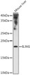 Western blot analysis of extracts of various cell lines, using IL36G antibody (STJ112204) at 1:1000 dilution. Secondary antibody: HRP Goat Anti-rabbit IgG (H+L) (STJS000856) at 1:10000 dilution. Lysates/proteins: 25 Mu g per lane. Blocking buffer: 3% non-fat dry milk in TBST. Detection: ECL Enhanced Kit. Exposure time: 180s.