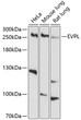 Western blot analysis of extracts of various cell lines, using EVPL antibody (STJ112253) at 1:1000 dilution. Secondary antibody: HRP Goat Anti-Rabbit IgG (H+L) (STJS000856) at 1:10000 dilution. Lysates/proteins: 25 Mu g per lane. Blocking buffer: 3% nonfat dry milk in TBST. Detection: ECL Basic Kit. Exposure time: 90s.