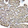 Immunohistochemistry analysis of paraffin-embedded mouse pancreas using RPS15A Rabbit polyclonal antibody (STJ112279) at dilution of 1:200 (40x lens). Perform high pressure antigen retrieval with 10 mM citrate buffer pH 6. 0 before commencing with immunohistochemistry staining protocol.