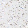 Immunohistochemistry analysis of paraffin-embedded mouse brain using RPS15A Rabbit polyclonal antibody (STJ112279) at dilution of 1:200 (40x lens). Perform high pressure antigen retrieval with 10 mM citrate buffer pH 6. 0 before commencing with immunohistochemistry staining protocol.