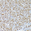Immunohistochemistry analysis of paraffin-embedded rat ovary using RPS15A Rabbit polyclonal antibody (STJ112279) at dilution of 1:200 (40x lens). Perform high pressure antigen retrieval with 10 mM citrate buffer pH 6. 0 before commencing with immunohistochemistry staining protocol.