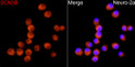 Immunofluorescence analysis of Neuro-2a cells using SCN3B rabbit polyclonal antibody (STJ112354) at dilution of 1:500 (40x lens). Blue: DAPI for nuclear staining.