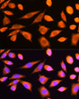 Immunofluorescence analysis of L929 cells using RPS20 antibody (STJ112400) at dilution of 1:100. Blue: DAPI for nuclear staining.