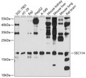 Western blot analysis of various lysates using SEC11A Rabbit polyclonal antibody (STJ112570) at 1:1000 dilution. Secondary antibody: HRP Goat Anti-Rabbit IgG (H+L) (STJS000856) at 1:10000 dilution. Lysates/proteins: 25 Mu g per lane. Blocking buffer: 3% nonfat dry milk in TBST. Detection: ECL Basic Kit. Exposure time: 90s.
