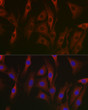 Immunofluorescence analysis of NIH/3T3 cells using NF-kB p65/RelA antibody (STJ112619) at dilution of 1:100 (40x lens). Blue: DAPI for nuclear staining.