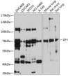 Western blot analysis of various lysates using ZP1 Rabbit polyclonal antibody (STJ112672) at 1:1000 dilution. Secondary antibody: HRP Goat Anti-Rabbit IgG (H+L) (STJS000856) at 1:10000 dilution. Lysates/proteins: 25 Mu g per lane. Blocking buffer: 3% nonfat dry milk in TBST. Detection: ECL Basic Kit. Exposure time: 90s.