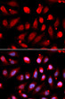 Immunofluorescence analysis of U2OS cells using EZH2/KMT6 Rabbit polyclonal antibody (STJ112944). Secondary antibody: Cy3 Goat Anti-Rabbit IgG (H+L) at 1:500 dilution.