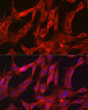 Immunofluorescence analysis of C6 cells using NF-kB p65/RelA Rabbit polyclonal antibody (STJ113018) at dilution of 1:200 (40x lens). Secondary antibody: Cy3 Goat Anti-Rabbit IgG (H+L) at 1:500 dilution. Blue: DAPI for nuclear staining.