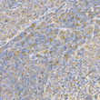 Immunohistochemistry analysis of paraffin-embedded rat spleen using Caspase-3 Rabbit polyclonal antibody (STJ113073) at dilution of 1:100 (40x lens). Perform high pressure antigen retrieval with 10 mM citrate buffer pH 6. 0 before commencing with immunohistochemistry staining protocol.