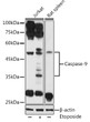Western blot analysis of extracts of various cell lines, using Caspase-9 antibody (STJ113147) at 1:1000 dilution. Jurkat cells were treated by Etoposide (25 uM) at 37 °C for 5 hours. Secondary antibody: HRP Goat Anti-Rabbit IgG (H+L) (STJS000856) at 1:10000 dilution. Lysates/proteins: 25 Mu g per lane. Blocking buffer: 3% nonfat dry milk in TBST. Detection: ECL Basic Kit. Exposure time: 90s.