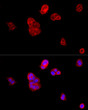 Immunofluorescence analysis of MCF7 cells using E-Cadherin rabbit polyclonal antibody (STJ113165) at dilution of 1:100 (40x lens). Blue: DAPI for nuclear staining.