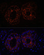 Immunofluorescence analysis of Human mammary cancer cells using TNF-Alpha antibody (STJ113176) at dilution of 1:100. Blue: DAPI for nuclear staining.