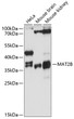 Western blot analysis of various lysates using MAT2B Rabbit polyclonal antibody (STJ113213) at 1:3000 dilution. Secondary antibody: HRP Goat Anti-Rabbit IgG (H+L) (STJS000856) at 1:10000 dilution. Lysates/proteins: 25 Mu g per lane. Blocking buffer: 3% nonfat dry milk in TBST. Detection: ECL Basic Kit. Exposure time: 30s.