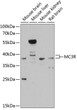 Western blot analysis of various lysates using MC3R Rabbit polyclonal antibody (STJ113214) at 1:3000 dilution. Secondary antibody: HRP Goat Anti-Rabbit IgG (H+L) (STJS000856) at 1:10000 dilution. Lysates/proteins: 25 Mu g per lane. Blocking buffer: 3% nonfat dry milk in TBST. Detection: ECL Basic Kit. Exposure time: 30s.