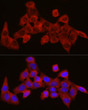Immunofluorescence analysis of HeLa cells using SEC61A1 rabbit polyclonal antibody (STJ113219) at dilution of 1:300 (40x lens). Blue: DAPI for nuclear staining.