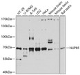 Western blot analysis of various lysates using NUP85 Rabbit polyclonal antibody (STJ113234) at 1:3000 dilution. Secondary antibody: HRP Goat Anti-Rabbit IgG (H+L) (STJS000856) at 1:10000 dilution. Lysates/proteins: 25 Mu g per lane. Blocking buffer: 3% nonfat dry milk in TBST. Detection: ECL Basic Kit. Exposure time: 10s. Western blot analysis of various lysates using NUP85 Rabbit polyclonal antibody (STJ113234) at 1:3000 dilution. Secondary antibody: HRP Goat Anti-Rabbit IgG (H+L) (STJS000856) at 1:10000 dilution. Lysates/proteins: 25 Mu g per lane. Blocking buffer: 3% nonfat dry milk in TBST. Detection: ECL Basic Kit. Exposure time: 10s.