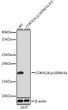 Western blot analysis of lysates from wild type (WT) and CDKN2A/p16INK4a knockout (KO) 293T cells, using CDKN2A/p16INK4a Rabbit monoclonal antibody (STJ113253) at 1:1000 dilution. Secondary antibody: HRP Goat Anti-Rabbit IgG (H+L) (STJS000856) at 1:10000 dilution. Lysates/proteins: 25 Mu g per lane. Blocking buffer: 3% nonfat dry milk in TBST. Detection: ECL Basic Kit. Exposure time: 3min. Western blot analysis of lysates from wild type (WT) and CDKN2A/p16INK4a knockout (KO) 293T cells, using CDKN2A/p16INK4a Rabbit monoclonal antibody (STJ113253) at 1:1000 dilution. Secondary antibody: HRP Goat Anti-Rabbit IgG (H+L) (STJS000856) at 1:10000 dilution. Lysates/proteins: 25 Mu g per lane. Blocking buffer: 3% nonfat dry milk in TBST. Detection: ECL Basic Kit. Exposure time: 3min.