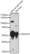 Western blot analysis of various lysates using SEC61A1 Rabbit polyclonal antibody (STJ113260) at 1:3000 dilution. Secondary antibody: HRP Goat Anti-Rabbit IgG (H+L) (STJS000856) at 1:10000 dilution. Lysates/proteins: 25 Mu g per lane. Blocking buffer: 3% nonfat dry milk in TBST. Detection: ECL Basic Kit. Exposure time: 30s.