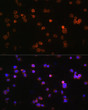 Immunofluorescence analysis of Jurkat cells using P2RX5 Rabbit polyclonal antibody (STJ113309) at dilution of 1:100 (40x lens). Secondary antibody: Cy3 Goat Anti-Rabbit IgG (H+L) at 1:500 dilution. Blue: DAPI for nuclear staining.