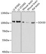 Western blot analysis of various lysates using SOX30 Rabbit polyclonal antibody (STJ113314) at 1:1000 dilution. Secondary antibody: HRP Goat Anti-Rabbit IgG (H+L) (STJS000856) at 1:10000 dilution. Lysates/proteins: 25 Mu g per lane. Blocking buffer: 3% nonfat dry milk in TBST. Detection: ECL Basic Kit. Exposure time: 10s.
