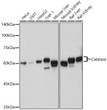 Western blot analysis of various lysates using Catalase Rabbit polyclonal antibody (STJ113364) at 1:1000 dilution. Secondary antibody: HRP Goat Anti-Rabbit IgG (H+L) (STJS000856) at 1:10000 dilution. Lysates/proteins: 25 Mu g per lane. Blocking buffer: 3% nonfat dry milk in TBST. Detection: ECL Basic Kit. Exposure time: 1s.