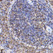 Immunohistochemistry analysis of TGF beta Receptor II (TGFBR2) in paraffin-embedded rat spleen using TGF beta Receptor II (TGF beta Receptor II (TGFBR2) ) Rabbit polyclonal antibody (STJ113371) at dilution of 1:100 (40x lens). Perform high pressure antigen retrieval with 10 mM citrate buffer pH 6. 0 before commencing with immunohistochemistry staining protocol.