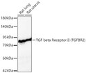 Western blot analysis of various lysates using TGF beta Receptor II (TGFBR2) Rabbit polyclonal antibody (STJ113371) at 1:1000 dilution. Secondary antibody: HRP Goat Anti-Rabbit IgG (H+L) (STJS000856) at 1:10000 dilution. Lysates/ proteins: 25 Mu g per lane. Blocking buffer: 3 % nonfat dry milk in TBST. Detection: ECL Basic Kit. Exposure time: 30s.