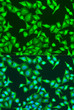 Immunofluorescence analysis of U2OS cells using Beta-Catenin antibody (STJ113475) at dilution of 1:100. Blue: DAPI for nuclear staining.