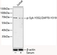 Western blot analysis of lysates from Jurkat cells, using Phospho-Syk-Y352/ZAP70-Y319 Rabbit pAb (STJ113483) at 1:1000 dilution. Jurkat cells were treated by 10% FBS for 30 minutes after serum-starvation overnight. <br/>Secondary antibody: HRP-conjugated Goat anti-Rabbit IgG (H+L) (STJS000856) at 1:10000 dilution. <br/>Lysates/proteins: 25 Mu g per lane. <br/>Blocking buffer: 3% BSA.