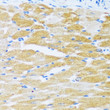 Immunohistochemistry analysis of SERCA2/ATP2A2 in paraffin-embedded rat heart using SERCA2/ATP2A2 Rabbit polyclonal antibody (STJ113534) at dilution of 1:100 (40x lens). Perform microwave antigen retrieval with 10 mM PBS buffer pH 7. 2 before commencing with immunohistochemistry staining protocol.