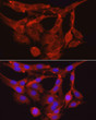 Immunofluorescence analysis of PC-12 cells using PPP1R12A Rabbit polyclonal antibody (STJ113547) at dilution of 1:100 (40x lens). Secondary antibody: Cy3 Goat Anti-Rabbit IgG (H+L) at 1:500 dilution. Blue: DAPI for nuclear staining.