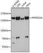 Western blot analysis of various lysates using PPP1R12A Rabbit polyclonal antibody (STJ113547) at 1:3000 dilution. Secondary antibody: HRP Goat Anti-Rabbit IgG (H+L) (STJS000856) at 1:10000 dilution. Lysates/proteins: 25 Mu g per lane. Blocking buffer: 3% nonfat dry milk in TBST. Detection: ECL Basic Kit. Exposure time: 90s.