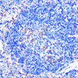 Immunohistochemistry analysis of CD86 in paraffin-embedded mouse spleen using CD86 Rabbit polyclonal antibody (STJ113561) at dilution of 1:100 (40x lens). Perform microwave antigen retrieval with 10 mM PBS buffer pH 7. 2 before commencing with immunohistochemistry staining protocol.