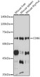 Western blot analysis of various lysates using CD86 Rabbit polyclonal antibody (STJ113561) at 1:1000 dilution. Secondary antibody: HRP Goat Anti-Rabbit IgG (H+L) (STJS000856) at 1:10000 dilution. Lysates/proteins: 25 Mu g per lane. Blocking buffer: 3% nonfat dry milk in TBST. Detection: ECL Enhanced Kit. Exposure time: 300s.