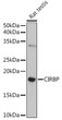 Western blot analysis of extracts of Rat testis, using CIRBP rabbit polyclonal antibody (STJ113565) at 1:1000 dilution. Secondary antibody: HRP Goat Anti-rabbit IgG (H+L) (STJS000856) at 1:10000 dilution. Lysates/proteins: 25 Mu g per lane. Blocking buffer: 3% non-fat dry milk in TBST. Detection: ECL Basic Kit. Exposure time: 180s.