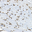 Immunohistochemistry analysis of paraffin-embedded rat brain using CIRBP rabbit polyclonal antibody (STJ113565) at dilution of 1:100 (40x lens). Perform microwave antigen retrieval with 10 mM PBS buffer pH 7. 2 before commencing with immunohistochemistry staining protocol.