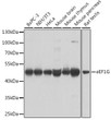 Western blot analysis of various lysates using eEF1G Rabbit pAb (STJ113571) at 1:1000 dilution. <br/>Secondary antibody: HRP-conjugated Goat anti-Rabbit IgG (H+L) (STJS000856) at 1:10000 dilution. <br/>Lysates/proteins: 25 Mu g per lane. <br/>Blocking buffer: 3% nonfat dry milk in TBST. <br/>Detection: ECL Basic Kit <br/>Exposure time: 5s.