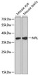 Western blot analysis of various lysates using NPL Rabbit pAb (STJ113623) at 1:3000 dilution. <br/>Secondary antibody: HRP-conjugated Goat anti-Rabbit IgG (H+L) (STJS000856) at 1:10000 dilution. <br/>Lysates/proteins: 25 Mu g per lane. <br/>Blocking buffer: 3% nonfat dry milk in TBST. <br/>Detection: ECL Basic Kit <br/>Exposure time: 90s.